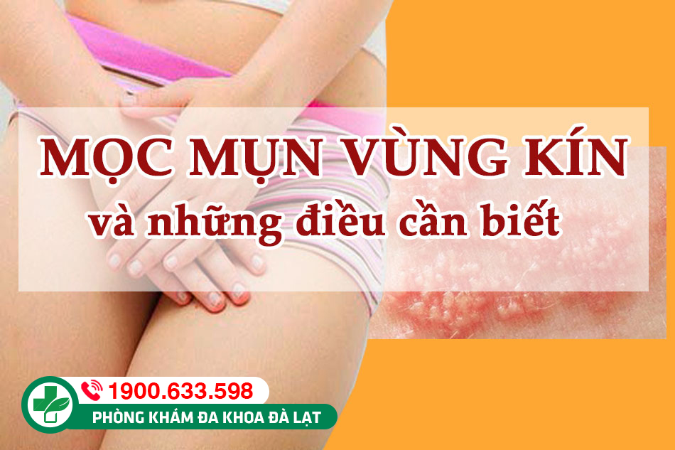 Mụn sinh dục ở nam & nữ giới: Tác hại và phương pháp điều trị mụn sinh dục